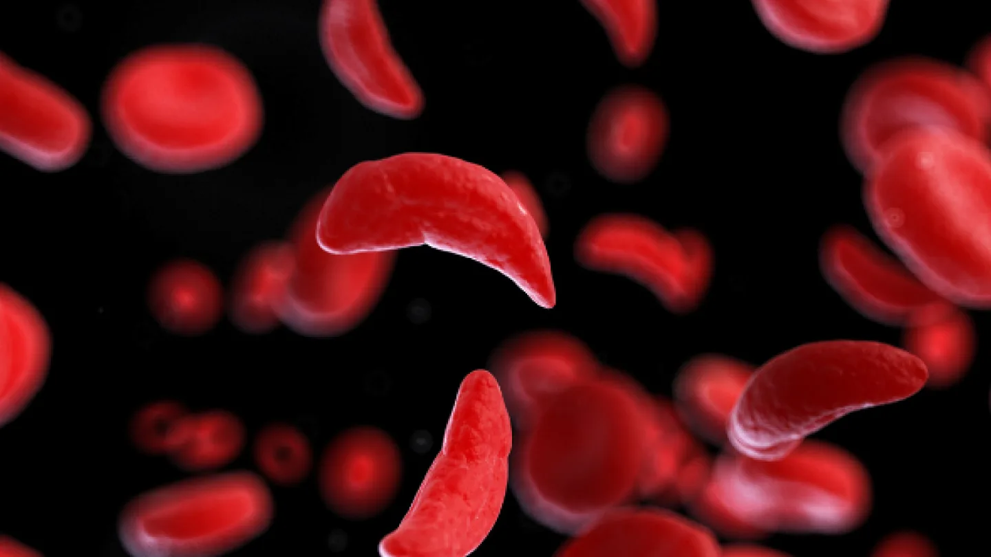 What is SCD?
